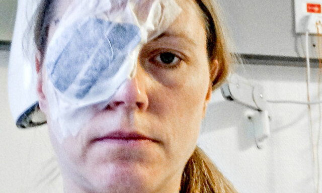 Føflekk-kreft kan dukke opp andre steder enn på huden i det skjulte